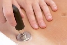 Indiba Therapie Cellulaire Laure Sainte Rose Sage Femme